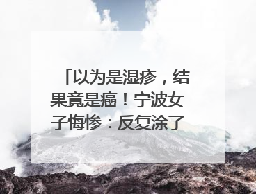 以为是湿疹，结果竟是癌！宁波女子悔惨：反复涂了一年药膏都没好！很多患者首诊都去了皮肤科